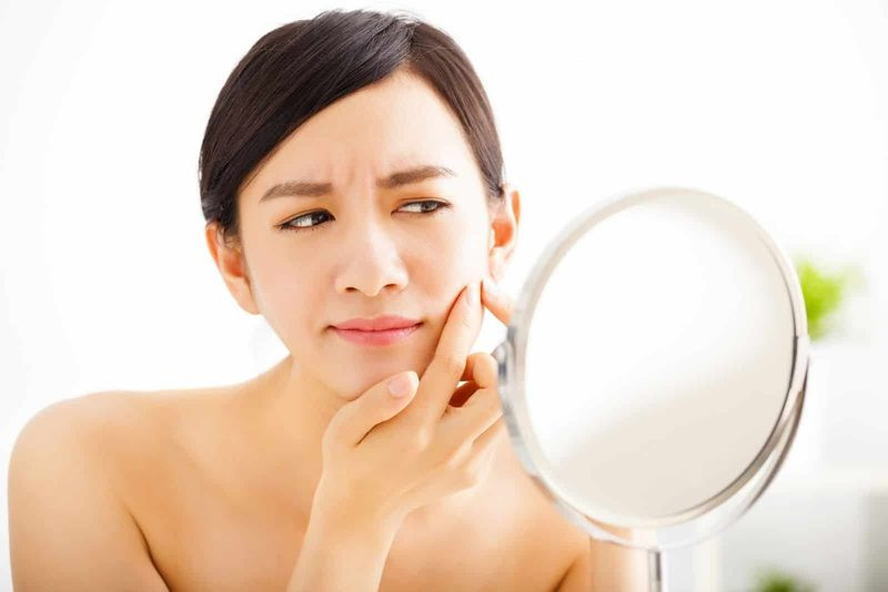 Cách Chăm Sóc Da Mụn Đúng Chuẩn Bạn Đã Thử Chưa?