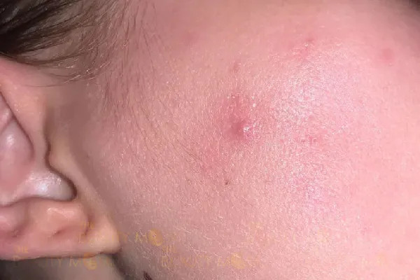 Da dễ bị kích ứng