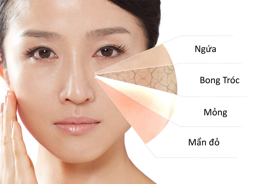 Tầm quan trọng và cách chọn mỹ phẩm cho từng loại da